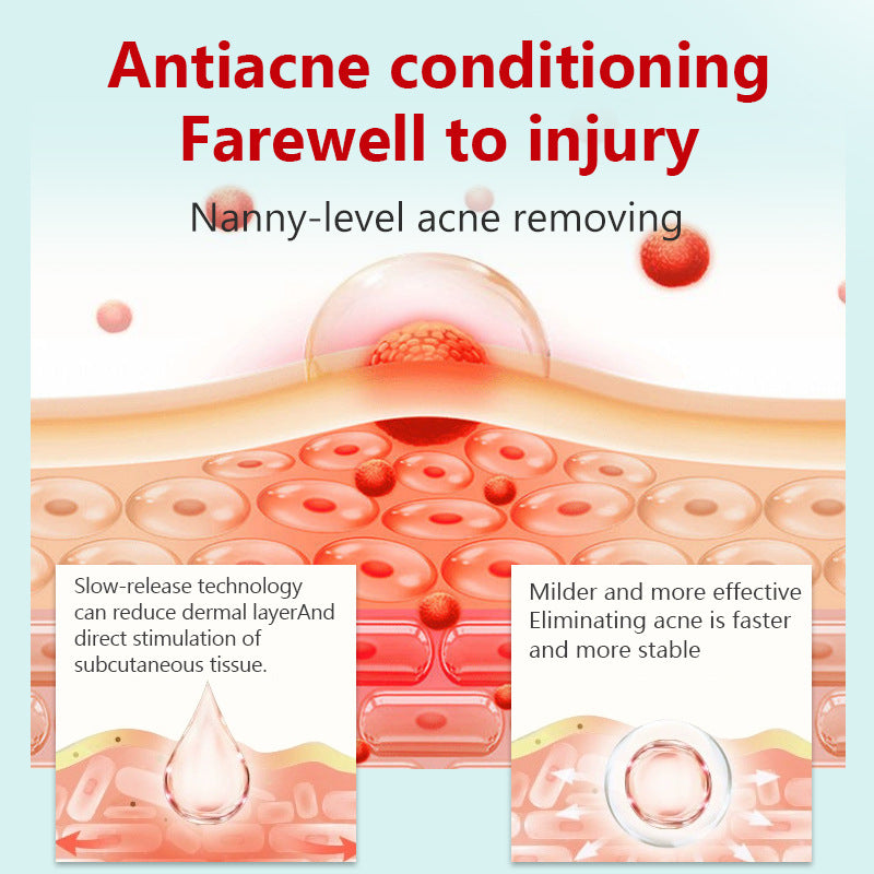 “Pure Herbal Power That Clears Acne Naturally 🌿”