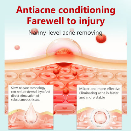 “Pure Herbal Power That Clears Acne Naturally 🌿”